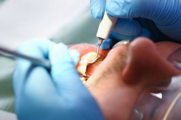 Best Urgent Care for Lost Fillings or Crowns in Arche, OK