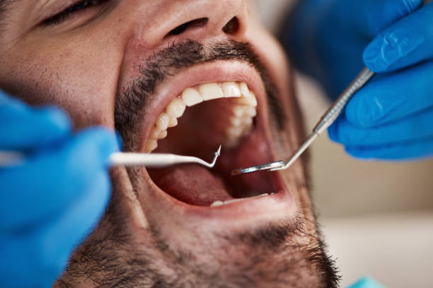 Best Same-Day Emergency Dental Services in Arche, OK
