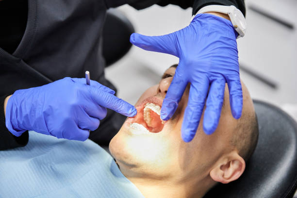 Best Emergency Treatment for Dental Infections or Abscesses in Arche, OK